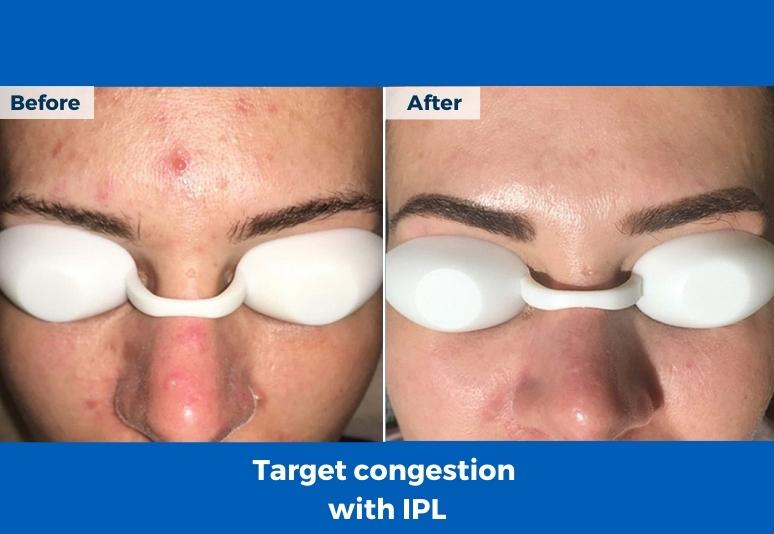 Tasmanian Skin Clinic in Devonport, Tasmania